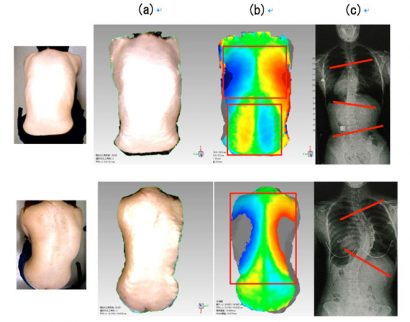 back-scanner