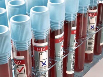 HIV virus drug discovery