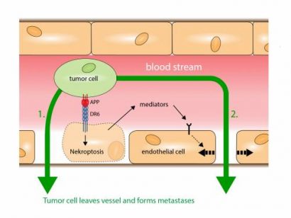 metastases cancer