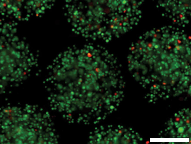 Figure 2. Fluorescence photomicrograph of freshly prepared alginate microspheres containing urinary bladder matrix (UBM) powder and Wharton's jelly stem cells (WJMSCs) double stained with Calcein-AM and propidium iodide (PI). Scale bar: 250 um