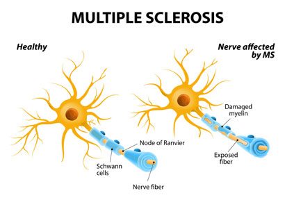 ms-infographic