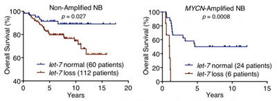 neuroblastoma