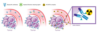 radioimmunotherapy