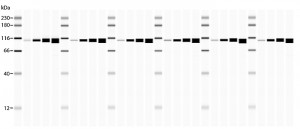 Detection of PI3 Kinase