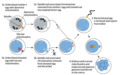 spindle-transfer