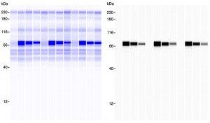 .  Total Protein detection (left) and Immune detection (right)