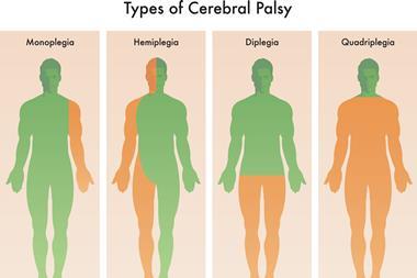 Forms,Of,Cerebral,Palsy,Illustrated,In,Medical,Diagram.