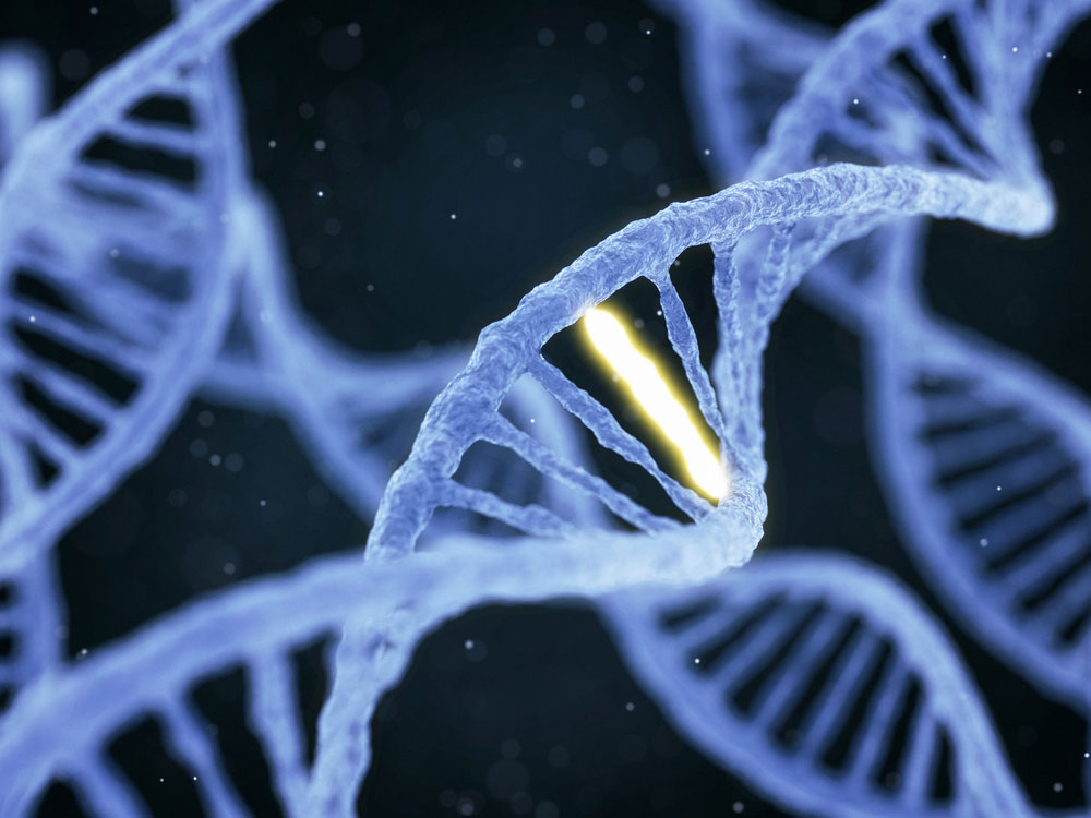 15q13.3 microdeletion syndrome