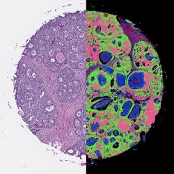 Stainless imaging of cancer