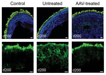  Top: Retinoids stained for DNA (blue), NPHP5 (red), and rhodopsin (green). Below: Close-up view of organoid photoreceptor layer stained green for rhodopsin