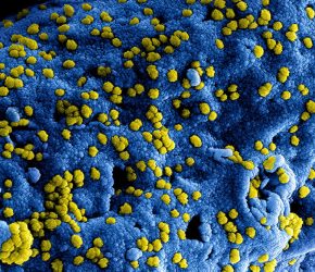 MERS virus particles