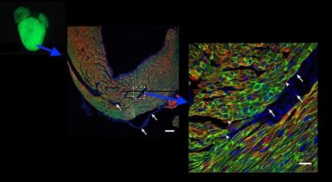 Barth syndrome gene therapy