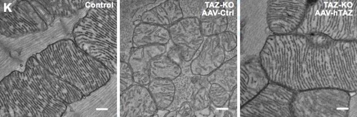 Barth syndrome mitochondria