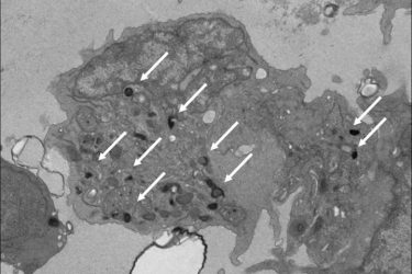 Natural killer cells