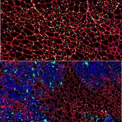 DMD muscle degeneration