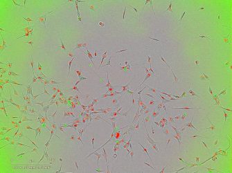 Intracellular vesicles