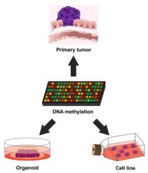 Cancer model