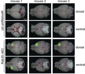 Glioblastoma in mice