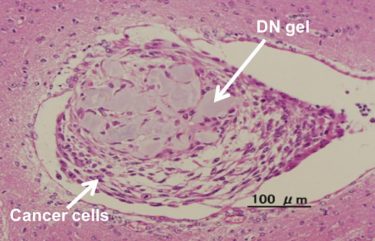 Cancer stem cell