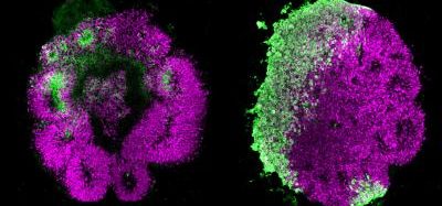 Brain organoids