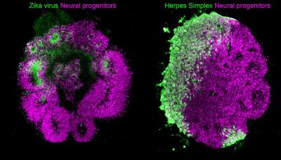 Brain organoids