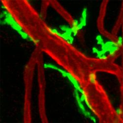 Macrophages and blood vessels