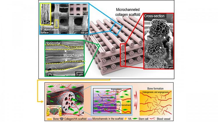 Microchannel scaffold