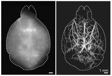 Imaging of brain