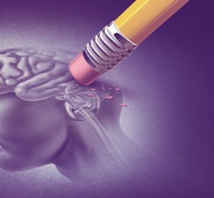 AI algorithm Alzheimer's