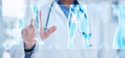 AI xray