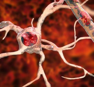 ALS neurons
