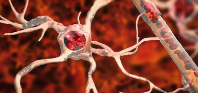 ALS neurons