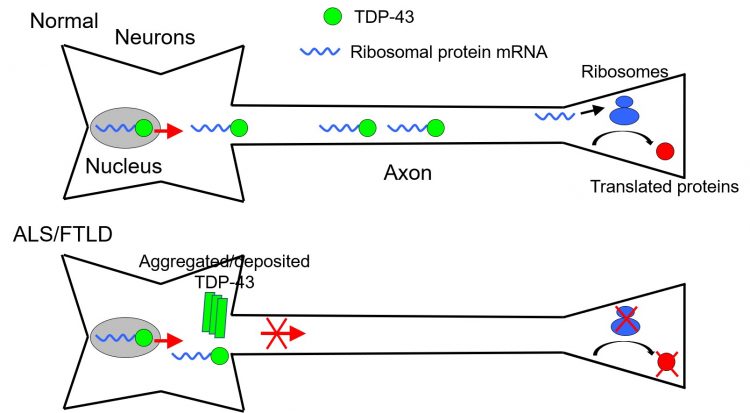 Figure 1 Model of ALS/FTLD pathology associated with abnormal deposition of TDP-43 [credit: National Center of Neurology and Psychiatry].