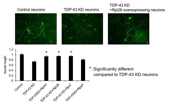 Figure 2 ibosomal protein mRNA partially reversed impaired axonal outgrowth found in TDP-43-knockdown (KD) neurons. Decrease of TDP-43 in mouse cortical neurons impaired axonal outgrowth, which was significantly improved by overexpression of individual ribosomal protein mRNAs [credit: National Center of Neurology and Psychiatry].