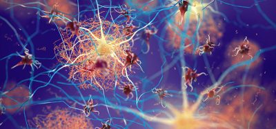 Alzheimer's neurons
