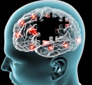 brain with puzzle pieces missing