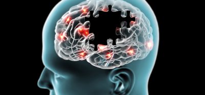 brain with puzzle pieces missing