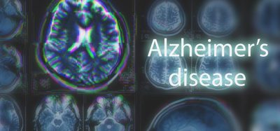 Alzheimer's disease