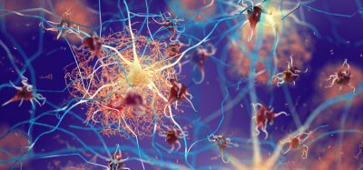 Alzheimer's neurons image