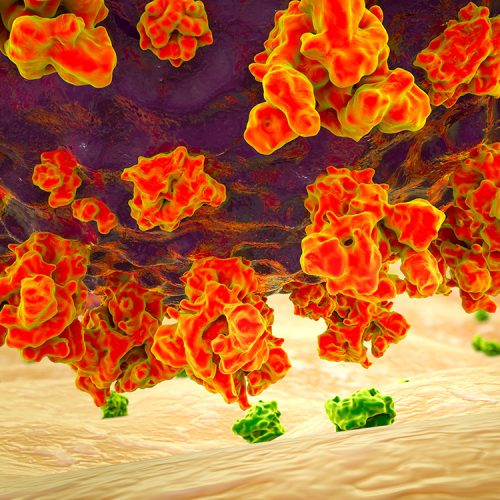 Purple SARS-CoV-2 particle with orange surface projections (Spike proteins) interacting with small green cell surface receptors (ACE2Rs)