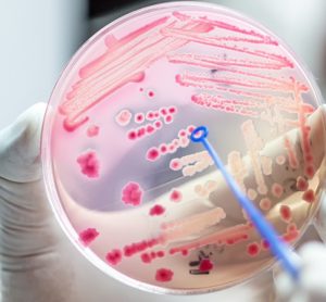 Bacteria in petri dish