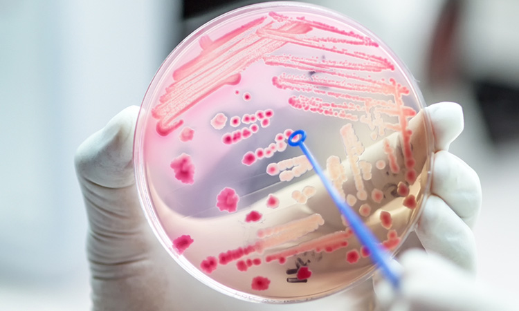 Bacteria in petri dish