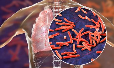 Microbiology in lungs