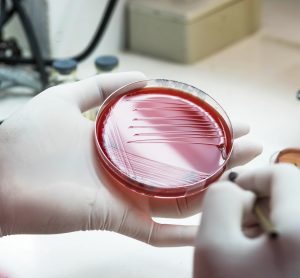 Agar plate in the hand of a medical technician working on bacterial culture and drug resistance.