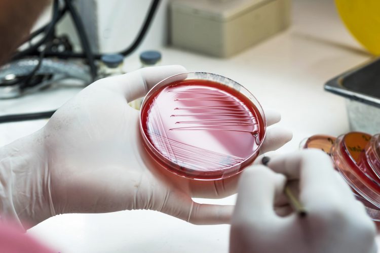 Agar plate in the hand of a medical technician working on bacterial culture and drug resistance.