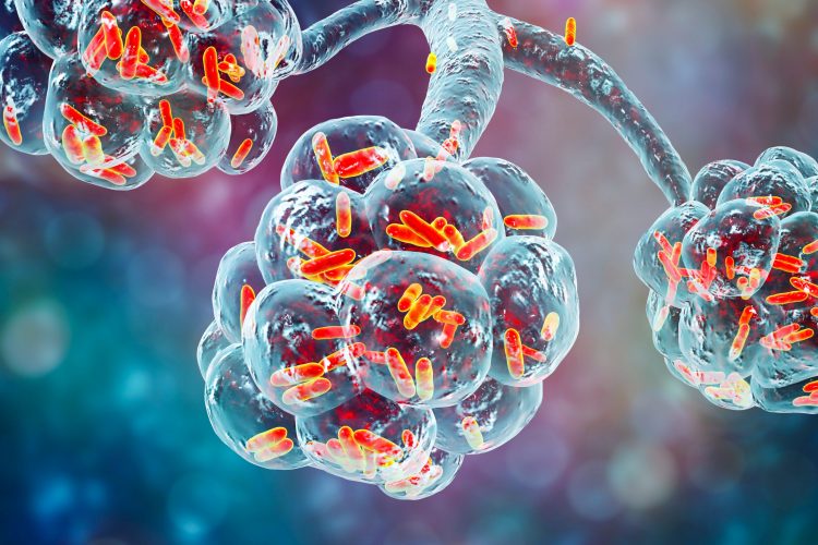 bacterial pneumonia cell