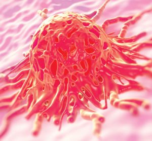 Biomarkers in solid tumours