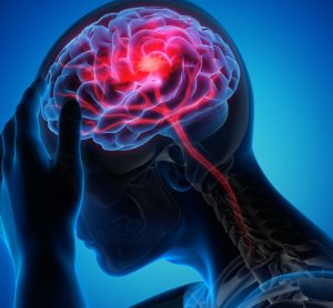 Brain-injury