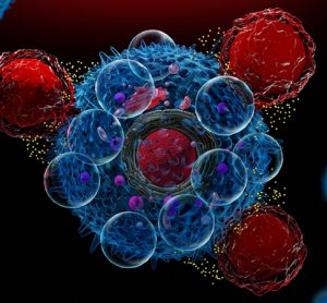 CAR T-cell therapy