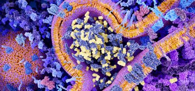 CAR-T cell therapy